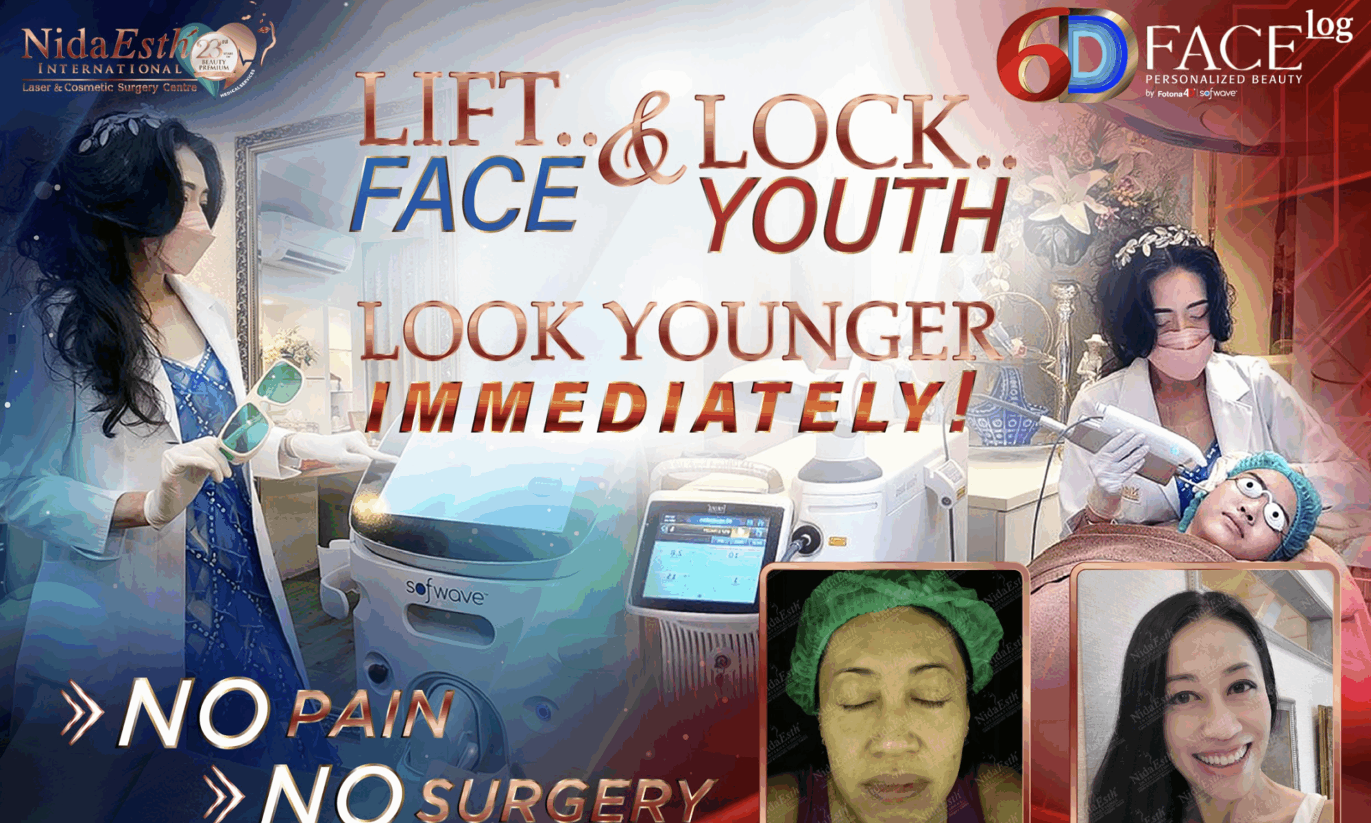 6D Face Log Face lift